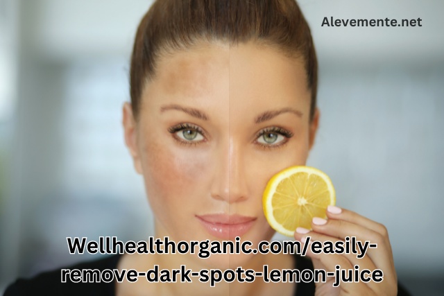 Wellhealthorganic.comeasily-remove-dark-spots-lemon-juice